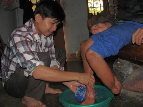  Những ngày rét, đôi chân Đào đau ê ẩm, các thầy cô phải đun nước nóng, hòa muối rửa chân cho em