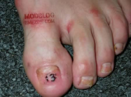 Hình xăm dưới móng chân cái, được anh John thuộc công ty HÌnh xăm Holdfast ở thành phố Atlantic, New Jersey thực hiện