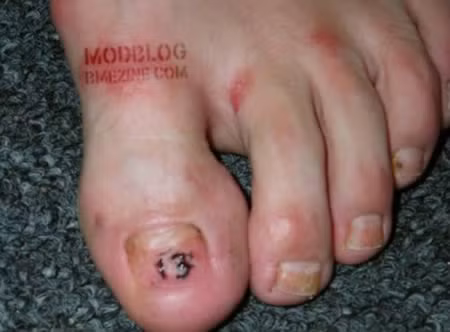 Hình xăm dưới móng chân cái, được anh John thuộc công ty HÌnh xăm Holdfast ở thành phố Atlantic, New Jersey thực hiện