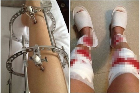 Bức ảnh cô gái nắn chân gây sốc