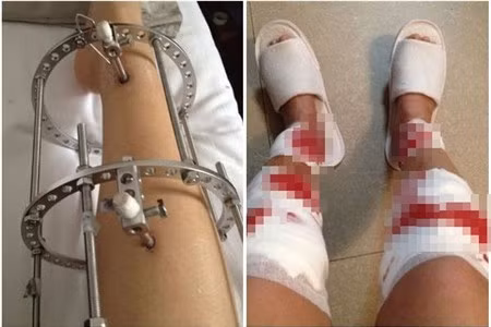 Bức ảnh cô gái nắn chân gây sốc. Bức ảnh cô gái nắn chân gây sốc