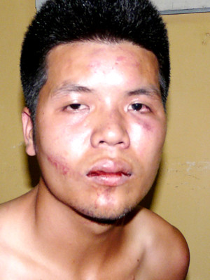 Đối tượng Đoàn Văn Vinh tại cơ quan điều tra