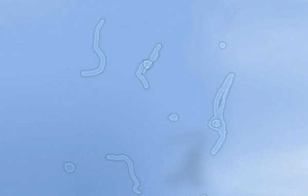 10 dấu hiệu đáng lo ngại trên cơ thể bạn không bao giờ được bỏ qua ảnh 4