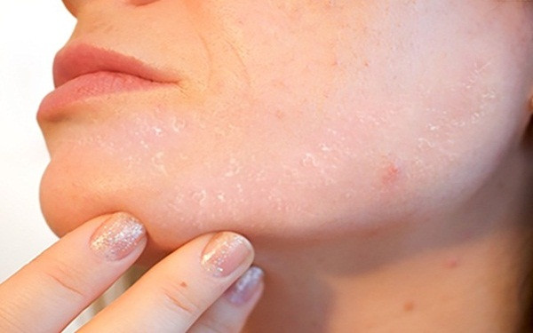 10 dấu hiệu đáng lo ngại trên cơ thể bạn không bao giờ được bỏ qua ảnh 6