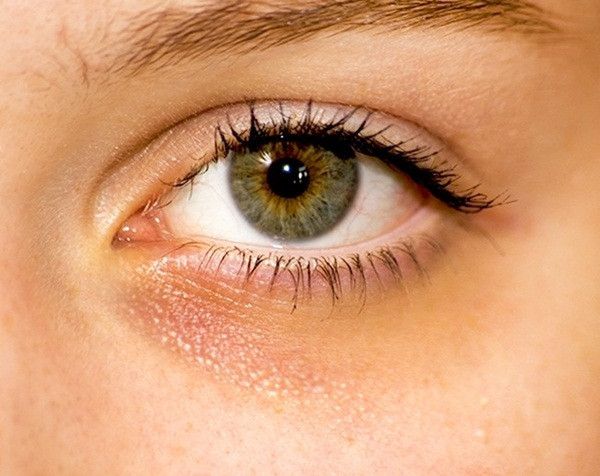 10 dấu hiệu đáng lo ngại trên cơ thể bạn không bao giờ được bỏ qua ảnh 1