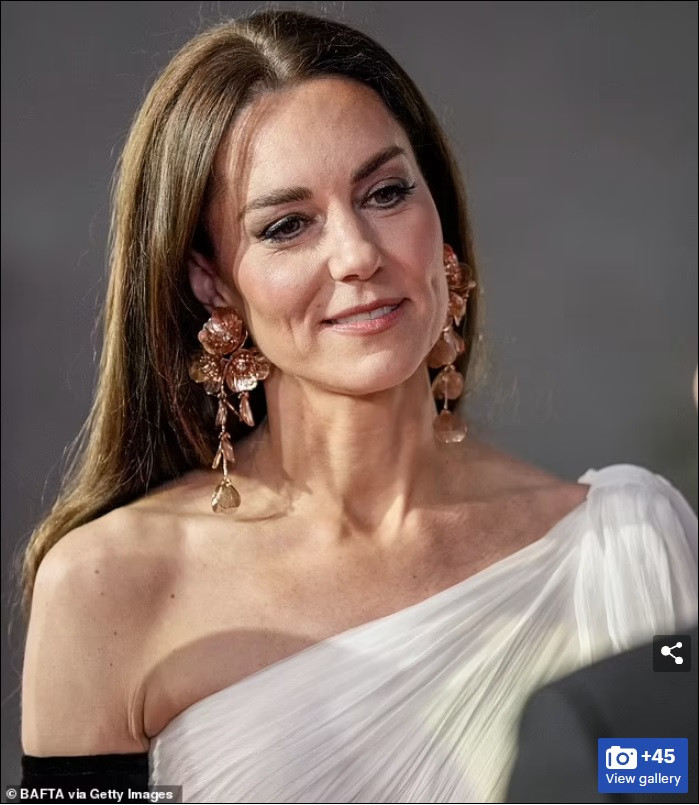 Nhìn cận, Công nương Kate lộ rõ dấu hiệu lão hóa trên gương mặt ở tuổi 41. Một số cư dân mạng cho rằng bà mẹ 3 con quá gầy. Ảnh: Getty Images.