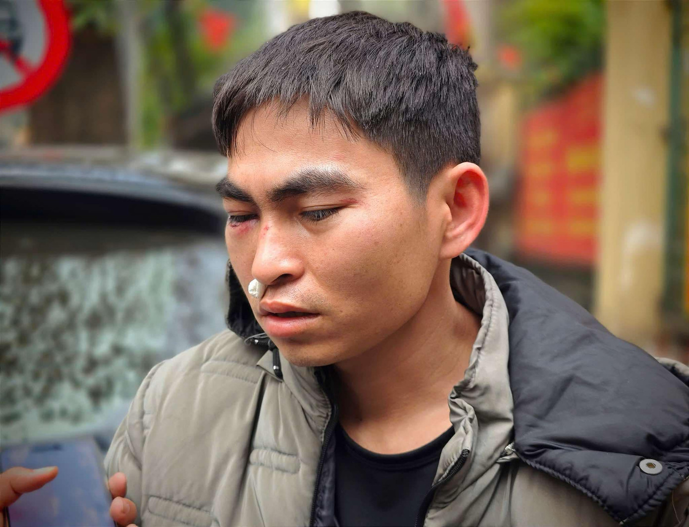 Anh Hưng bị hành hung dẫn đến thương tích. Anh Hưng bị hành hung dẫn đến thương tích.