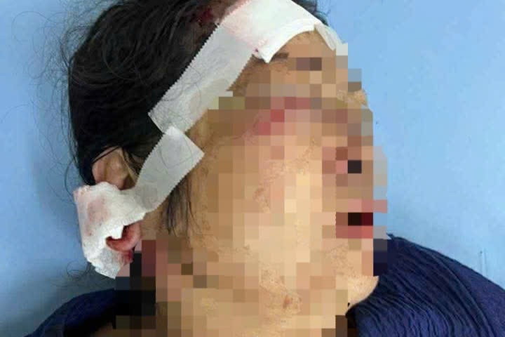 Người phụ nữ nhập viện với nhiều vết thương. Ảnh: CACC Người phụ nữ nhập viện với nhiều vết thương. Ảnh: CACC