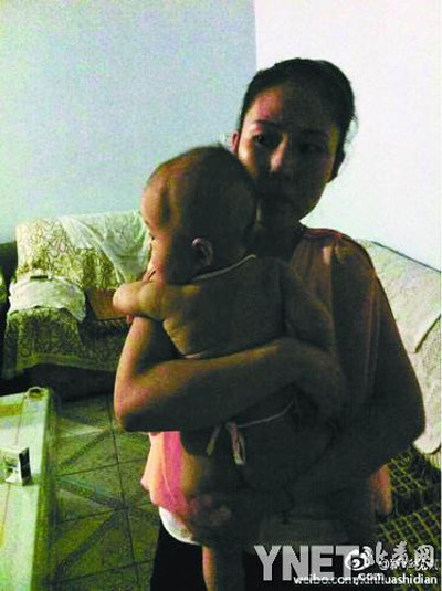 Bé gái Yueyue bị nứt sọ nhưng đã qua cơn nguy hiểm. Ảnh: Tân Hoa Xã