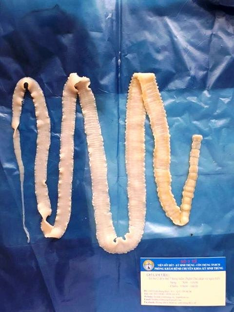 Ăn phải thực phẩm nhiễm sán lợn bao lâu xét nghiệm sẽ ra kết quả? ảnh 1