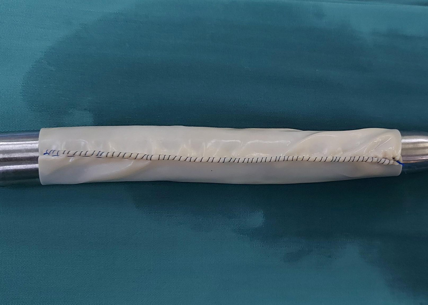 Màng ngoài tim bò được dùng để làm ống thay thé đoạn động mạch của bệnh nhân. Màng ngoài tim bò được dùng để làm ống thay thé đoạn động mạch của bệnh nhân.