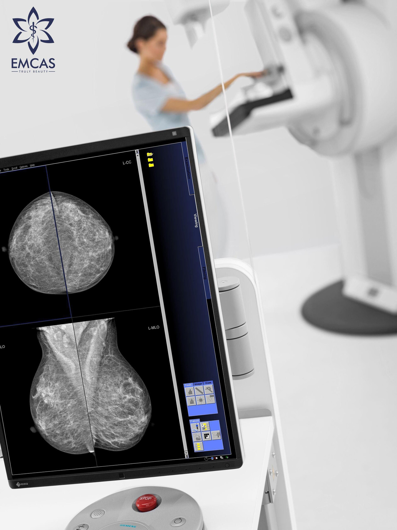 Máy X-Quang nhũ ảnh kỹ thuật số MAMMOMAT Fusion Máy X-Quang nhũ ảnh kỹ thuật số MAMMOMAT Fusion