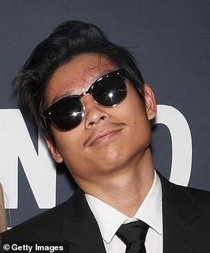 Pax Thiên có vết sẹo lớn trên mặt sau vụ tai nạn xe đạp điện. Ảnh: Getty Images/GC Images. Pax Thiên có vết sẹo lớn trên mặt sau vụ tai nạn xe đạp điện. Ảnh: Getty Images/GC Images.