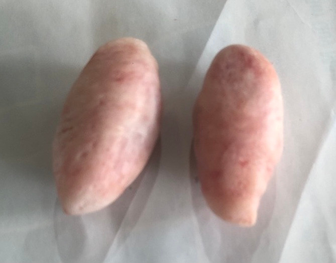 Hai viên đá kỳ lạ trong bụng con cá rún. Hai viên đá kỳ lạ trong bụng con cá rún.