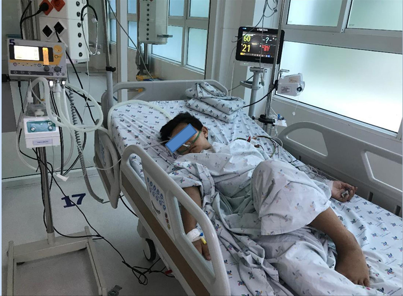 Bệnh nhi bị sốc SXH được điều trị