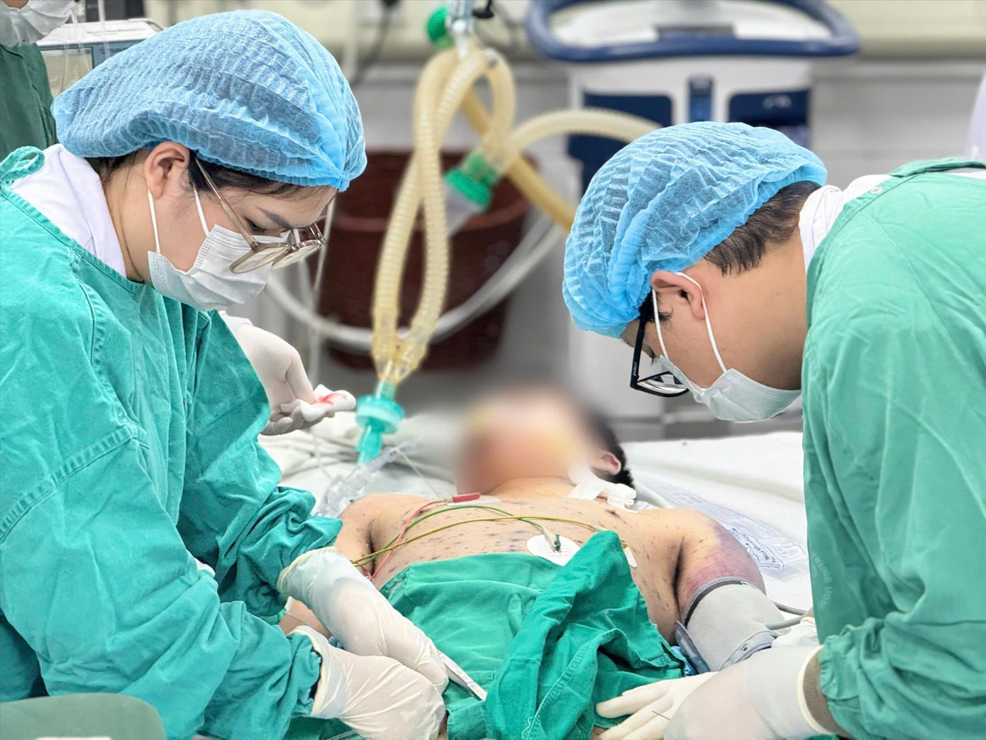 Bệnh nhân mắc thủy đậu vẫn trong tình trạng nguy kịch