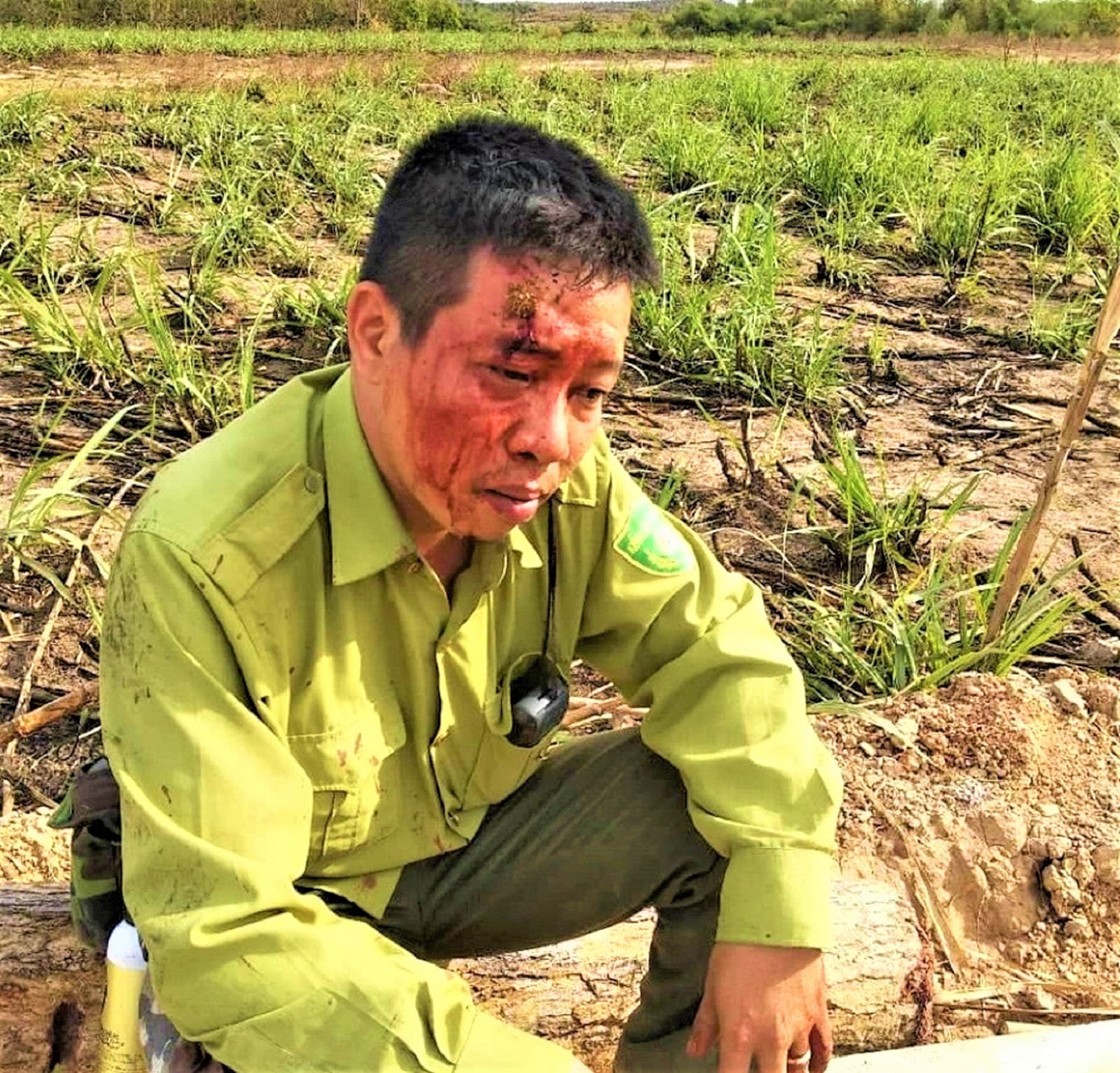 Anh Tiến bị thương trong một lần bị “lâm tặc” tấn công.