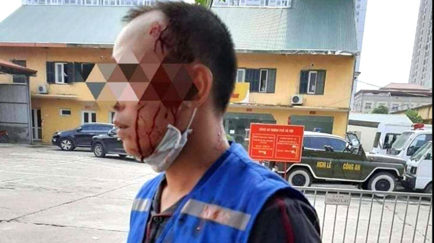 Anh Q., nhân viên của Trung tâm sửa chữa, bảo dưỡng ô tô sau khi bị đối tượng dùng kéo đâm