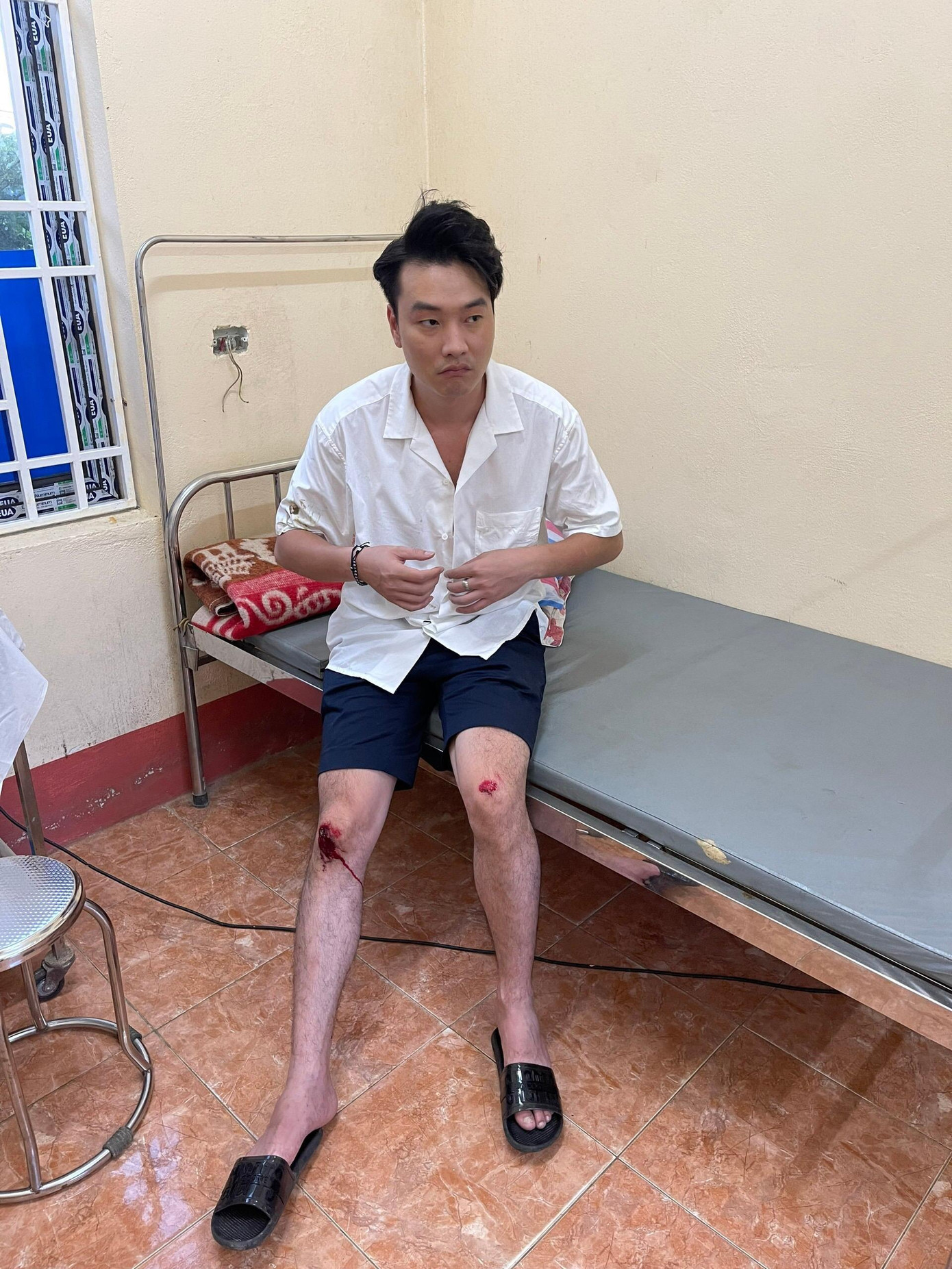 Diễn viên Trọng Lân gặp tai nạn trên phim trường “Thông Gia Ngõ Hẹp”