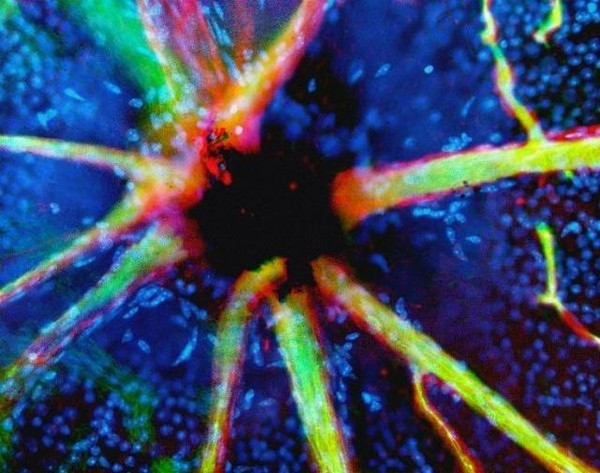 Mạch máu ở dây thần kinh thị giác. Mạch máu ở dây thần kinh thị giác