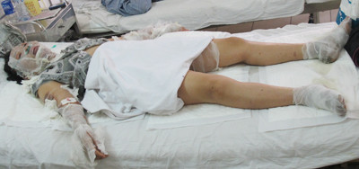 Chị Luyến đang được cấp cứu. Anh: Phạm Duẩn. Chị Luyến đang được cấp cứu. Anh: Phạm Duẩn