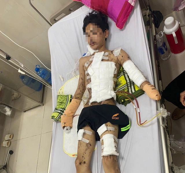 Nam sinh nhập viện trong tình trạng tổn thương toàn thân. Nam sinh nhập viện trong tình trạng tổn thương toàn thân.