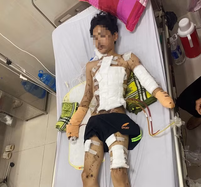 Nam sinh nhập viện trong tình trạng tổn thương toàn thân. Nam sinh nhập viện trong tình trạng tổn thương toàn thân.