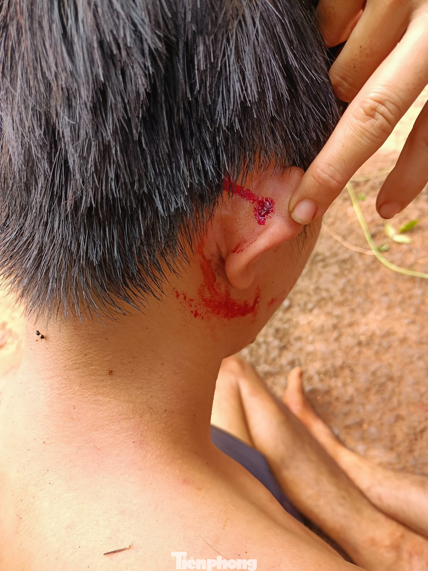 Nam thanh niên bị đánh chảy máu đầu