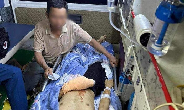 Nam sinh được đưa đến bệnh viện cấp cứu trong tình trạng nát bàn tay trái.