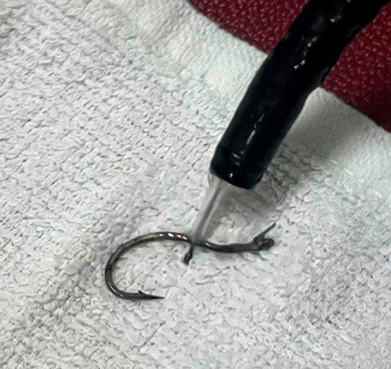 Chiếc lưỡi câu mắc trong thực quản bệnh nhân.