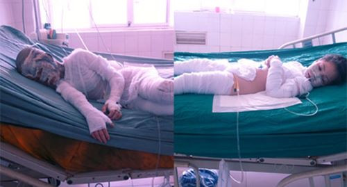 Hai nạn nhân trong vụ cả gia đình bị tạt axit tại Nam Định