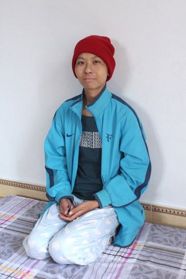 Thời gian đầu mới phẫu thuật xong, Thuần luôn phải đội mũ vì đầu bị rụng hết tóc. Ảnh: Bình Minh.