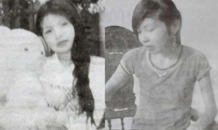 Nguyễn Thị Tuyến trước (ảnh trái) và sau khi mắc căn bệnh kỳ lạ Nguyễn Thị Tuyến trước (ảnh trái) và sau khi mắc căn bệnh kỳ lạ . Nguyễn Thị Tuyến trước (ảnh trái) và sau khi mắc căn bệnh kỳ lạ Nguyễn Thị Tuyến trước (ảnh trái) và sau khi mắc căn bệnh kỳ lạ