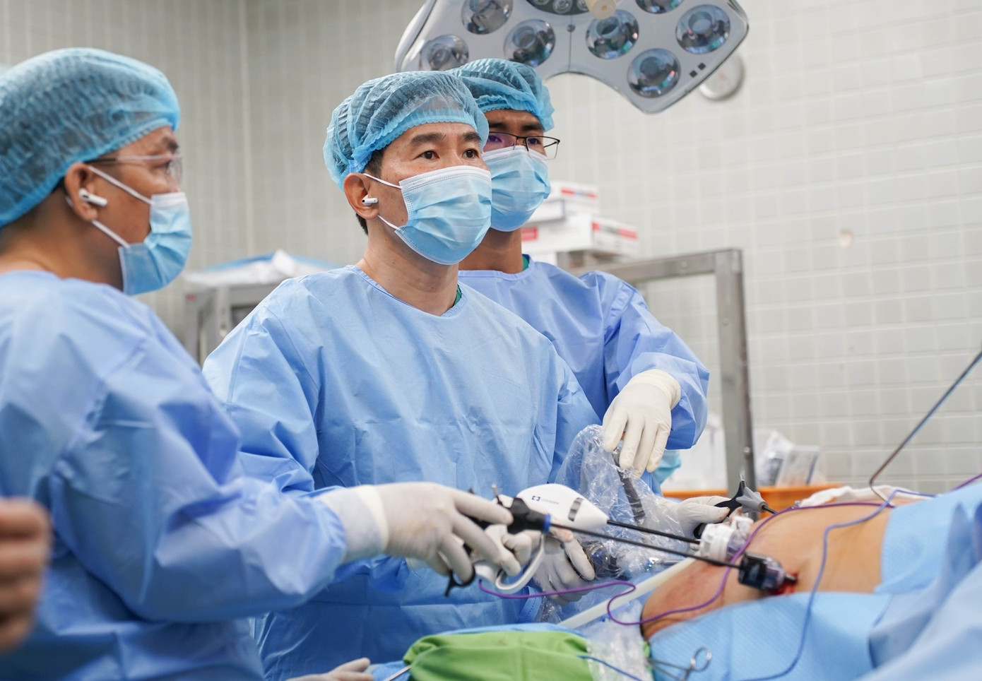 Các bác sĩ đã thực hiện cuộc phẫu nội soi cắt dạ dày giảm béo cho người bệnh