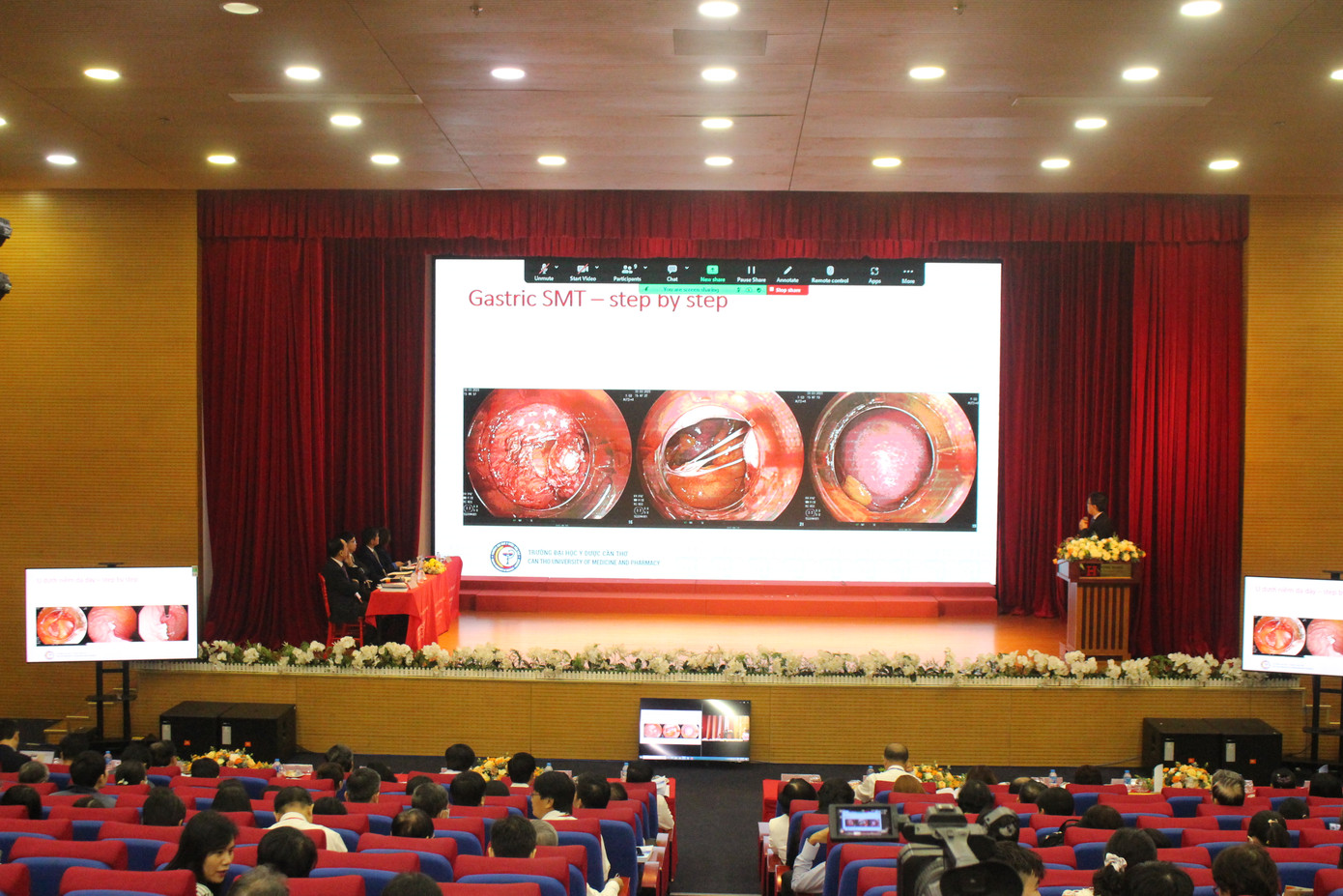 Thạc sĩ La Vĩnh Phúc, Bệnh viện Trường Đại học Y Dược Cần Thơ báo cáo về phương pháp cắt u niêm mạc đường tiêu hóa qua nội soi Thạc sĩ La Vĩnh Phúc, Bệnh viện Trường Đại học Y Dược Cần Thơ báo cáo về phương pháp cắt u niêm mạc đường tiêu hóa qua nội soi