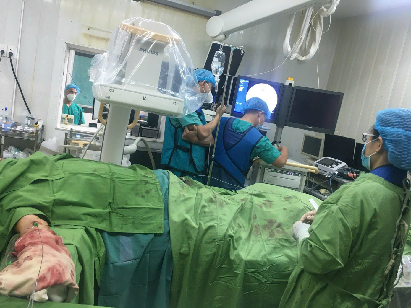 Các bác sĩ Bệnh viện Thống Nhất can thiệp tái thông mạch máu cho người bệnh (ảnh: BVCC) Các bác sĩ Bệnh viện Thống Nhất can thiệp tái thông mạch máu cho người bệnh (ảnh: BVCC)