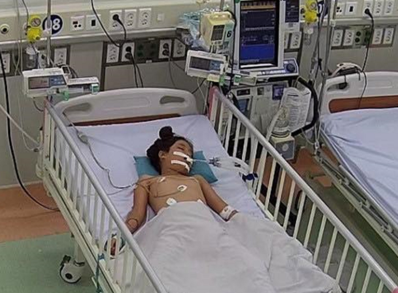 Bệnh nhi được cấp cứu, điều trị tích cực tại Bệnh viện Nhi Đồng 1 TPHCM Bệnh nhi được cấp cứu, điều trị tích cực tại Bệnh viện Nhi Đồng 1 TPHCM