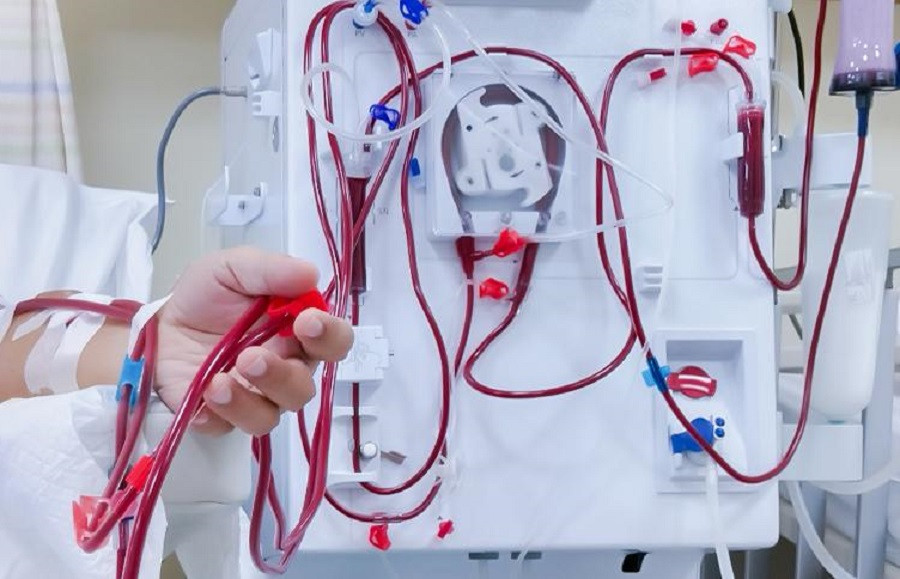 Bệnh nhân đã phải lọc máu liên tục, điều trị tích cực mới vượt qua được nguy kịch (ảnh minh họa) Bệnh nhân đã phải lọc máu liên tục, điều trị tích cực mới vượt qua được nguy kịch (ảnh minh họa)