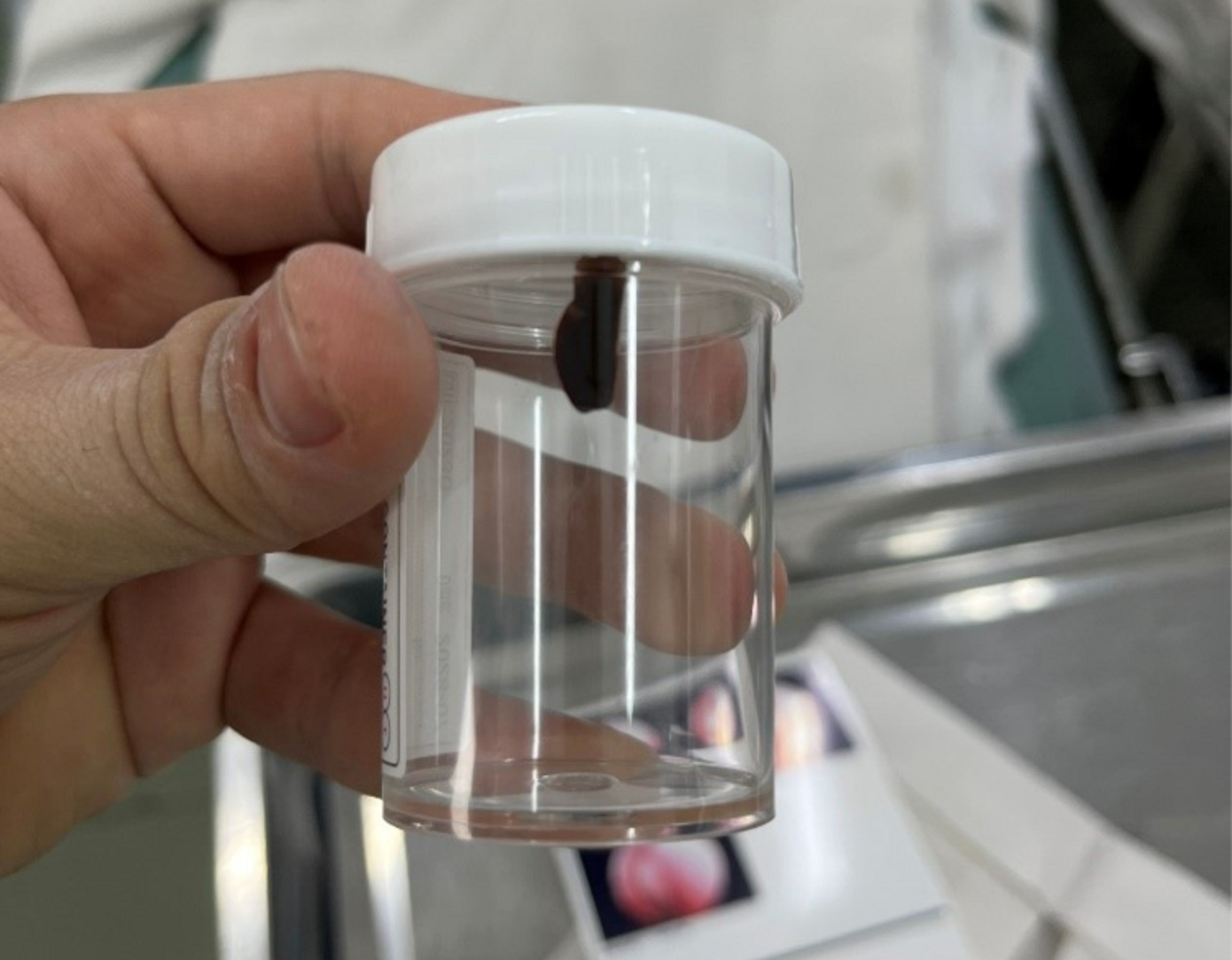 Con vắt được bác sĩ thực hiện nội soi gắp ra từ lỗ mũi của bệnh nhi Con vắt được bác sĩ thực hiện nội soi gắp ra từ lỗ mũi của bệnh nhi