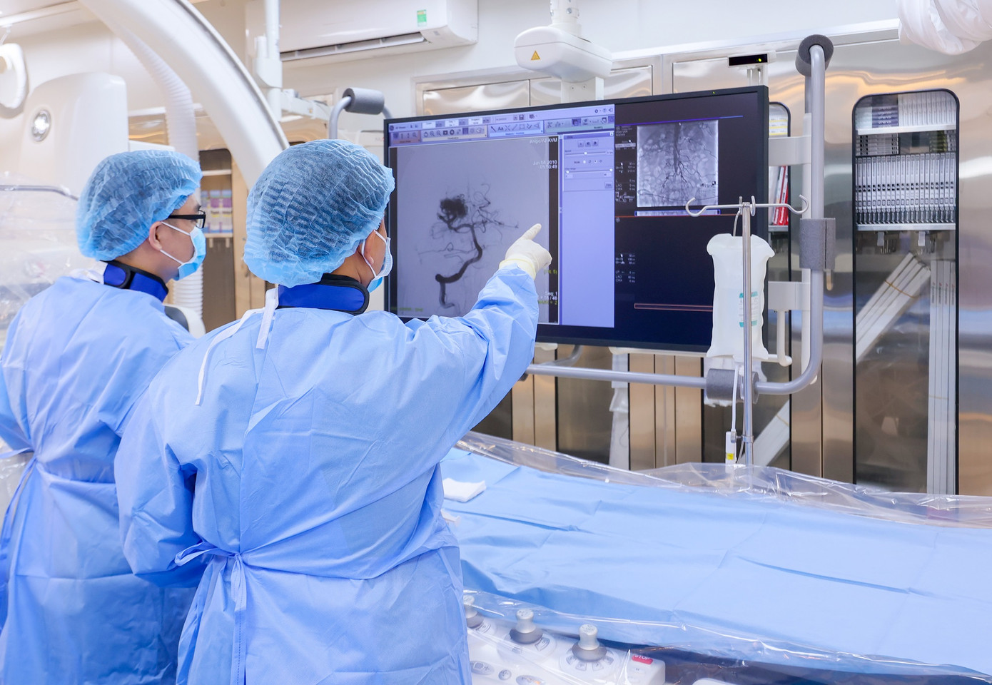 Các bác sĩ đã tiến hành can thiệp nội mạch gây tắc túi phình ngăn chặn thành công vị trí xuất huyết trong não bệnh nhân Các bác sĩ đã tiến hành can thiệp nội mạch gây tắc túi phình ngăn chặn thành công vị trí xuất huyết trong não bệnh nhân