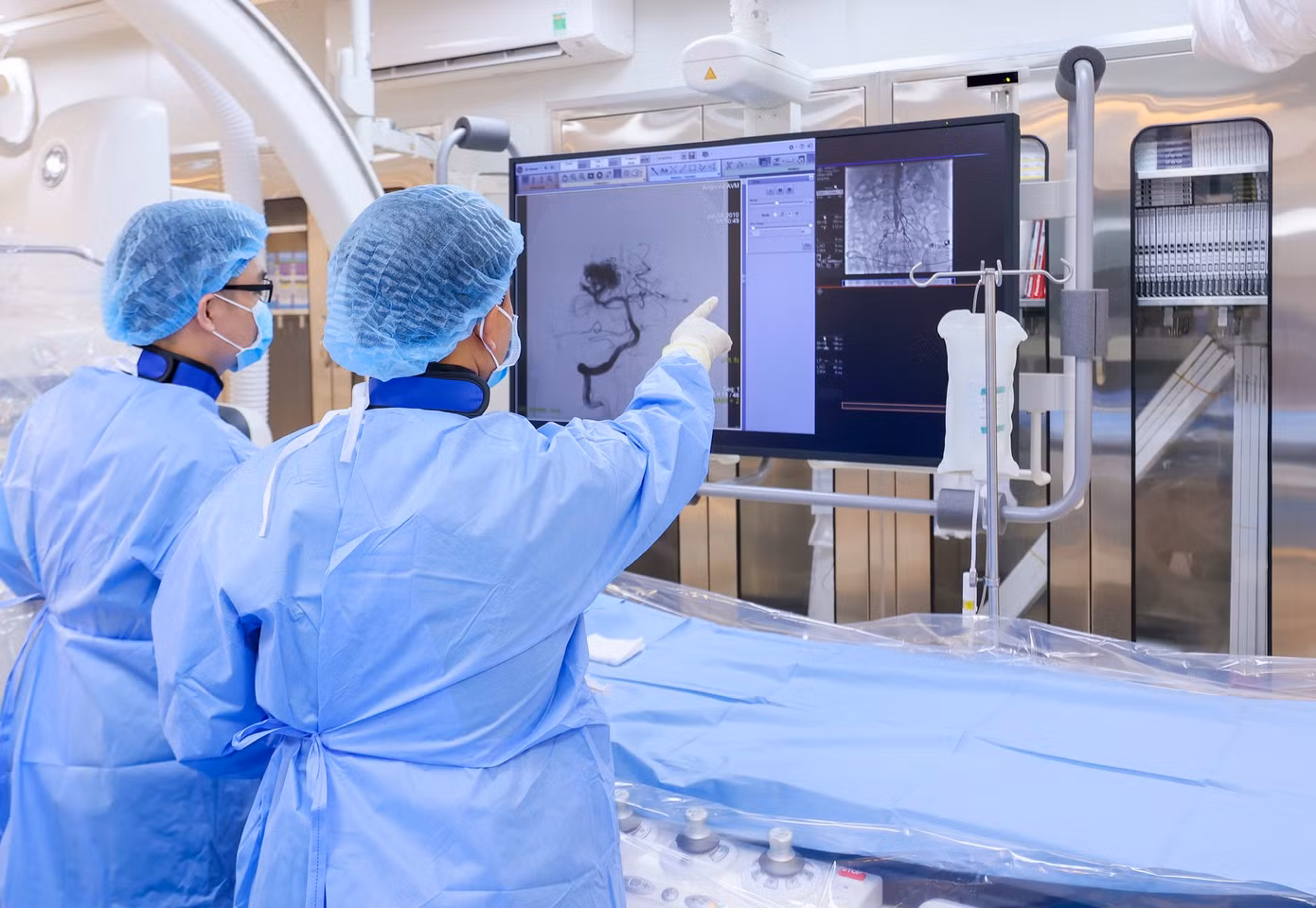 Các bác sĩ đã tiến hành can thiệp nội mạch gây tắc túi phình ngăn chặn thành công vị trí xuất huyết trong não bệnh nhân Các bác sĩ đã tiến hành can thiệp nội mạch gây tắc túi phình ngăn chặn thành công vị trí xuất huyết trong não bệnh nhân