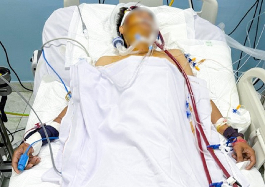 Bệnh nhân trong quá trình can thiệp ECMO tại bệnh viện Nhân Dân Gia Định (ảnh: BVCC) Bệnh nhân trong quá trình can thiệp ECMO tại bệnh viện Nhân Dân Gia Định (ảnh: BVCC)