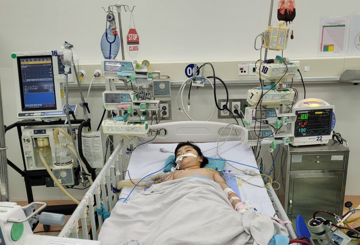 Các bác sĩ đã nỗ lực cấp cứu, điều trị tích cực giúp bệnh nhi qua cơn nguy kịch Các bác sĩ đã nỗ lực cấp cứu, điều trị tích cực giúp bệnh nhi qua cơn nguy kịch