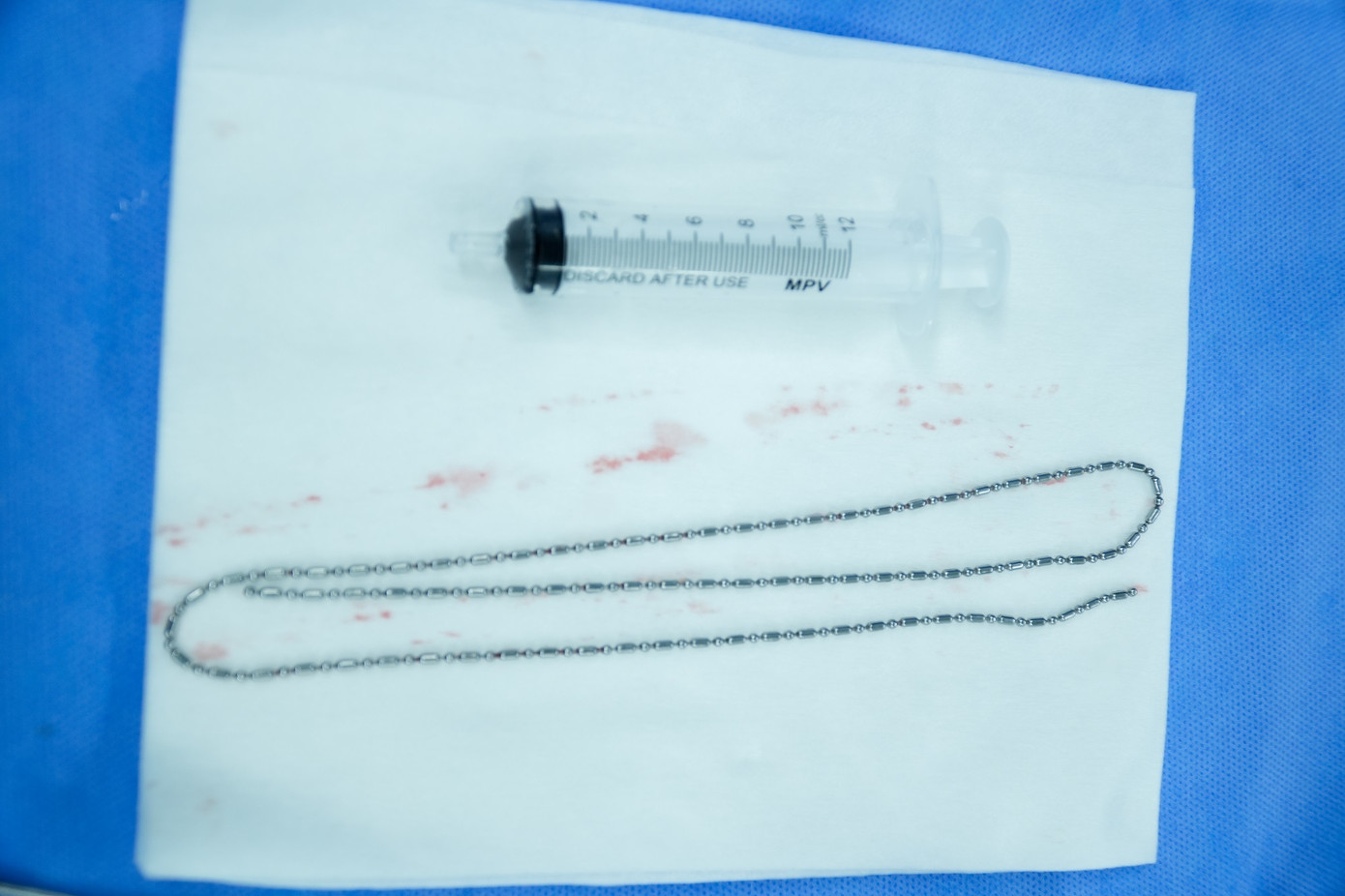 Sợi dây chuyền kim loại dài khoảng 60cm bệnh nhân dùng để thủ dâm được bác sĩ lấy ra khỏi bàng quang Sợi dây chuyền kim loại dài khoảng 60cm bệnh nhân dùng để thủ dâm được bác sĩ lấy ra khỏi bàng quang