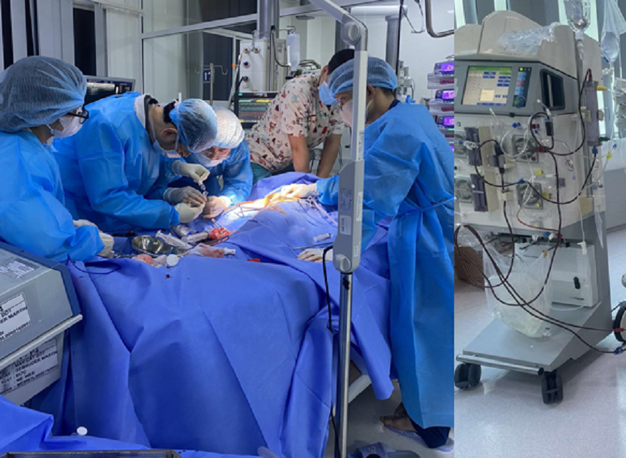 Ê kíp bác sĩ đã nỗ lực cấp cứu, đặt ECMO giúp bệnh nhi vượt qua nguy kịch Ê kíp bác sĩ đã nỗ lực cấp cứu, đặt ECMO giúp bệnh nhi vượt qua nguy kịch