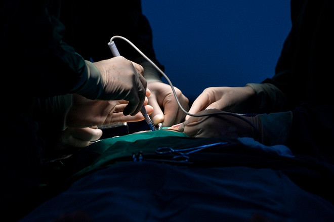 Nữ bệnh nhân đã rơi vào tình trạng xuất huyết não, nguy kịch sau phẫu thuật thẩm mỹ (ảnh minh họa)