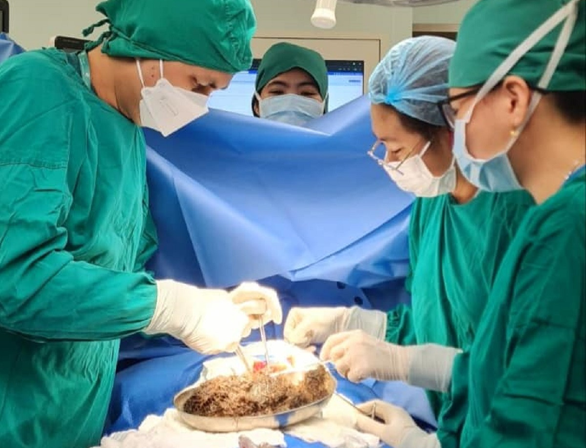 Các bác sĩ thực hiện cuộc phẫu thuật cấp cứu lấy khối dị vật trong đường tiêu hóa của bệnh nhi