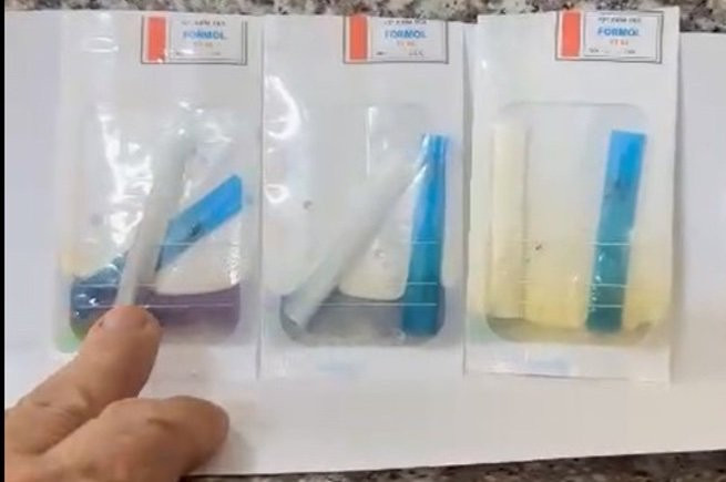 3 mẫu bún của Công ty Nguyễn Bính sau test nhanh có chứa hàn the và formol