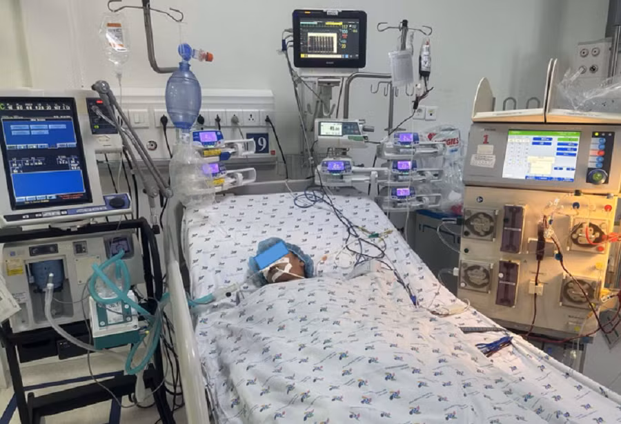 Trường hợp bệnh nhi bị ong đốt 52 mũi phải thở máy, lọc máu mới qua được nguy kịch Trường hợp bệnh nhi bị ong đốt 52 mũi phải thở máy, lọc máu mới qua được nguy kịch