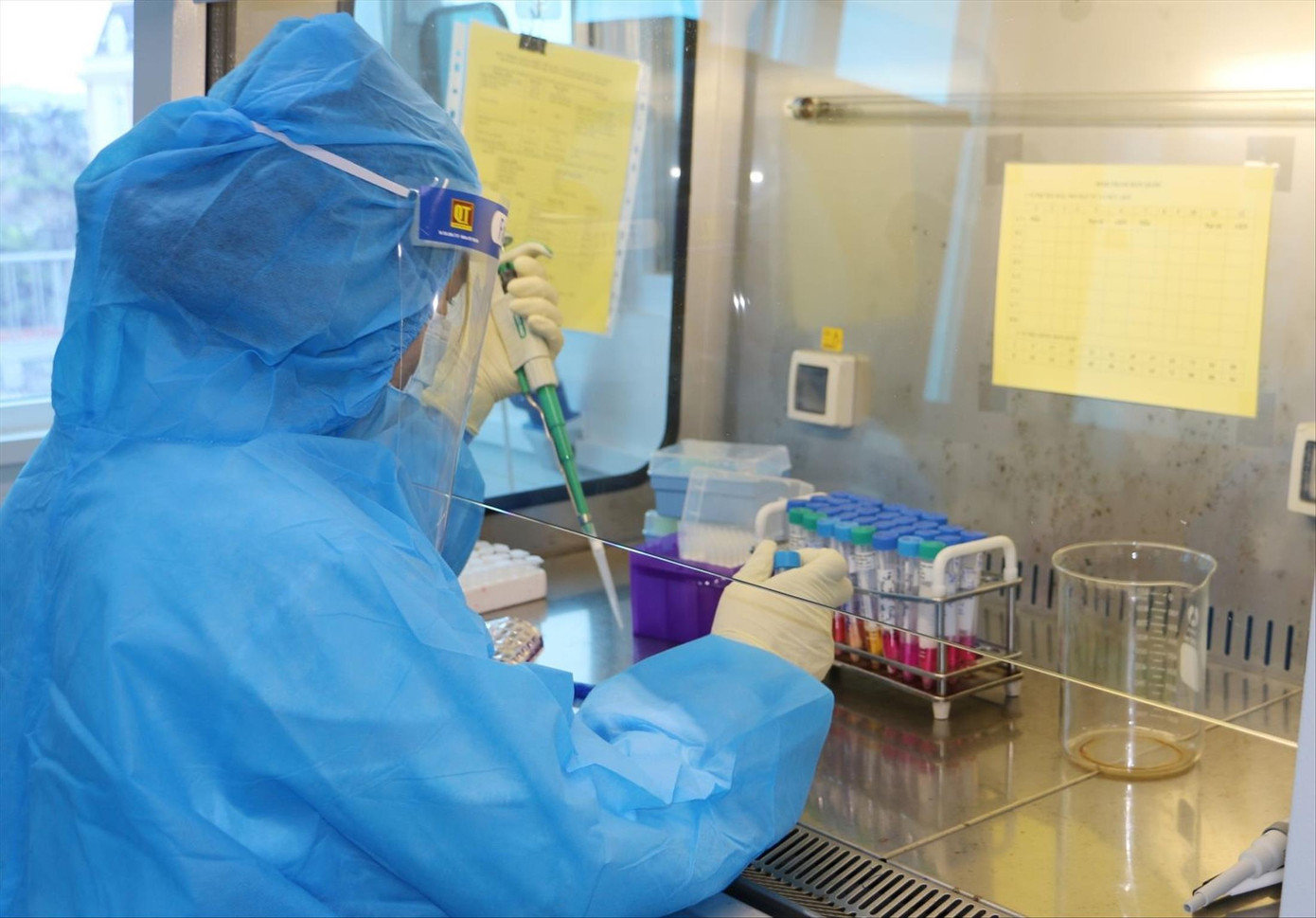 Xét nghiệm tìm biến thể phụ mới BA.5 Xét nghiệm tìm biến thể phụ mới BA.5